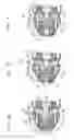 Fig. 03 - Chuck mechanism of striking tool