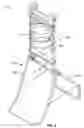 Fig. 03 - Combination cart and stand device