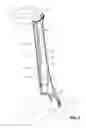 Fig. 04 - Vehicle pillar trim panel assembly