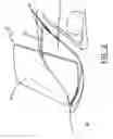 Fig. 03 - UPPER WINDSHIELD QUIET CLIP