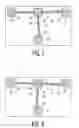Fig. 05 - Proportional variable resistor structures to electrically measure mask misalignment