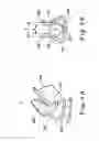 Fig. 07 - Antenna clip and its applications