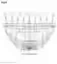 Fig. 09 - LIGHTING APPARATUS USING FILTER AND CONDENSER FOR LED ILLUMINATION