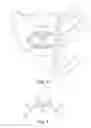 Fig. 03 - Small dental X-ray apparatus and method for positioning an X-ray emitter