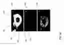 Fig. 06 - Quantitative single image-based magnetization transfer weighted imaging using an inter-subject normalization reference within the image