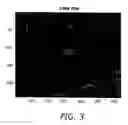 Fig. 04 - System and method for image registration based on variable region of interest