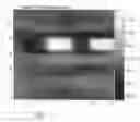 Fig. 07 - System and method for image registration based on variable region of interest