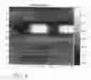 Fig. 08 - System and method for image registration based on variable region of interest