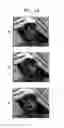 Fig. 17 - Method of redundant picture coding using polyphase downsampling and the codec using the method