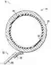 Fig. 01 - Acoustic dampening material for imaging drum