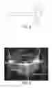 Fig. 03 - Powder Injection Microchip