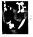 Fig. 04 - Composition and Method for Direct Visualization of the Human Appendix