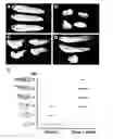 Fig. 01 - Bone Morphogenetic Variants, Compositions and Methods of Treatment