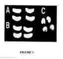Fig. 07 - Bone Morphogenetic Variants, Compositions and Methods of Treatment