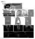 Fig. 04 - Methods and Compositions for Use in Treating Vascular Diseases and Conditions