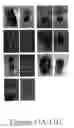 Fig. 27 - GRP94-BASED COMPOSITIONS AND METHODS OF USE THEREOF
