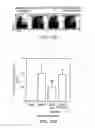 Fig. 22 - Stimulation of thymus for vaccination development