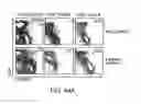 Fig. 49 - Stimulation of thymus for vaccination development