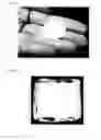 Fig. 02 - Therapeutic Polymeric Pouch
