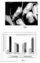 Fig. 08 - Novel Anticancer Agent, Methods for Obtaining the Same and Pharmaceutical Compositions Thereof