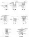 Fig. 53 - Methods of forming inter-poly dielectric (IPD) layers in power semiconductor devices