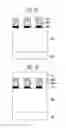 Fig. 03 - METHOD OF FORMING METAL WIRE IN SEMICONDUCTOR DEVICE