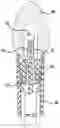 Fig. 01 - LED bulb assembly
