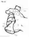 Fig. 10 - Swinging implement