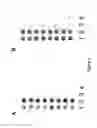 Fig. 04 - Protein chips for HPV detection