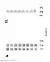Fig. 07 - Protein chips for HPV detection