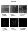 Fig. 11 - Treatment of multiple sclerosis and other autoimmune diseases by use of calpin inhibitors