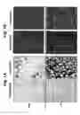 Fig. 02 - Methods for reduction of adipose tissue mass