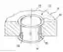 Fig. 01 - Wound retraction apparatus and method