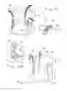 Fig. 04 - Wound retraction apparatus and method