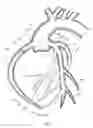 Fig. 02 - Methods for intravascular engraftment in heart