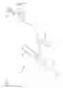 Fig. 02 - Vascular access device septum venting