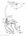 Fig. 02 - System and method for processing and storing signal information in an implantable cardiac device