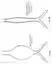 Fig. 07 - Methods and systems for making a blood vessel sleeve