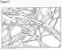 Fig. 03 - Method for Producing Duroplastic Fine-Fiber Non-Wovens Having a High Flame-Retardant, Thermal Protective and Sound Insulating Effect