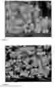 Fig. 07 - Hydroxyapatite with controllable size and morphology