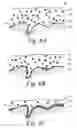 Fig. 11 - Bio-absorbable oil suspension