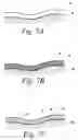 Fig. 12 - Bio-absorbable oil suspension