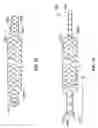 Fig. 09 - APPARATUS AND CONSTRUCTION FOR INTRAVASCULAR DEVICE