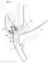 Fig. 08 - Application of procedure through natural orifice