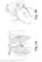 Fig. 02 - Pre-formed delivery catheters