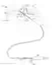 Fig. 01 - Cervical distraction method