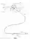 Fig. 03 - Cervical distraction method