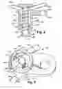 Fig. 04 - Fluid jet with noise reducing sleeve
