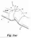 Fig. 02 - Distributor