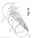 Fig. 11 - Distributor